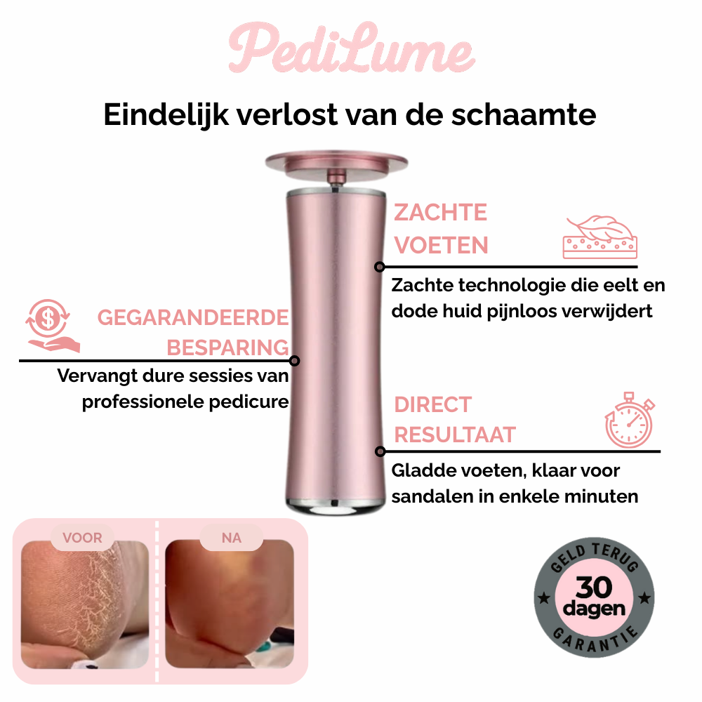 PediLume™ Pro - Verwijder Eelt Voorgoed